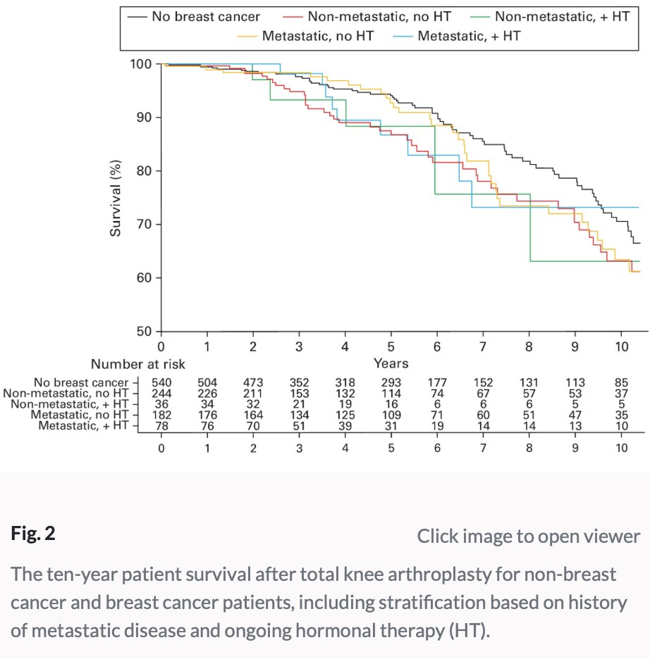 LifetimeHip (@lifetimehip) on Twitter photo Breast cancer pts after #hipreplacement #kneereplacement?
No ⬆ mortality
No ⬆ reoperation
2x complications after THA
- intraop fracture
- VTE
<a href="/BoneJointJ/">The Bone & Joint Journal</a>
buff.ly/ooDqFcU Breast cancer pts after #hipreplacement #kneereplacement?
No ⬆ mortality
No ⬆ reoperation
2x complications after THA
- intraop fracture
- VTE
<a href="/BoneJointJ/">The Bone & Joint Journal</a>
buff.ly/ooDqFcU