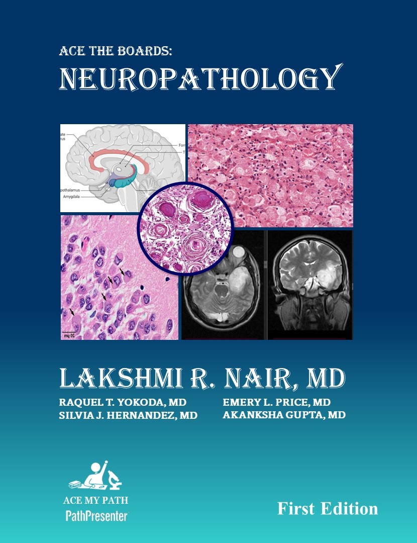 Silvia Judith Hernández (@silvia_hdzmd) on Twitter photo Winner of the <a href="/AceMyPath/">Ace My Path</a> Neuropathology Book at the LXVI Meeting of the Mexican Association of Pathology, Nuropathology "Dr. Juan E. Olvera" Module <a href="/DrOlveraRabiela/">Juan E. Olvera Rabiela</a> Module. Congratulations! #Neuropath Winner of the <a href="/AceMyPath/">Ace My Path</a> Neuropathology Book at the LXVI Meeting of the Mexican Association of Pathology, Nuropathology "Dr. Juan E. Olvera" Module <a href="/DrOlveraRabiela/">Juan E. Olvera Rabiela</a> Module. Congratulations! #Neuropath
