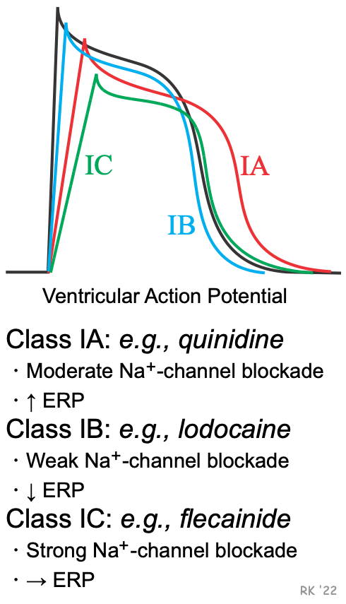 #CardioNuggets

🫀 Class IC Antiarrhythmics: Flecainide &amp; Propafenone

🔹 Strong Na⁺ channel blockers → ↓ conduction velocity (Phase 0)
🔹 Great for AF in structurally normal hearts

🚫 Avoid in CAD or HF
➡️ Proarrhythmia risk in post-MI (CAST trial)
➡️ Negative inotropy 💔