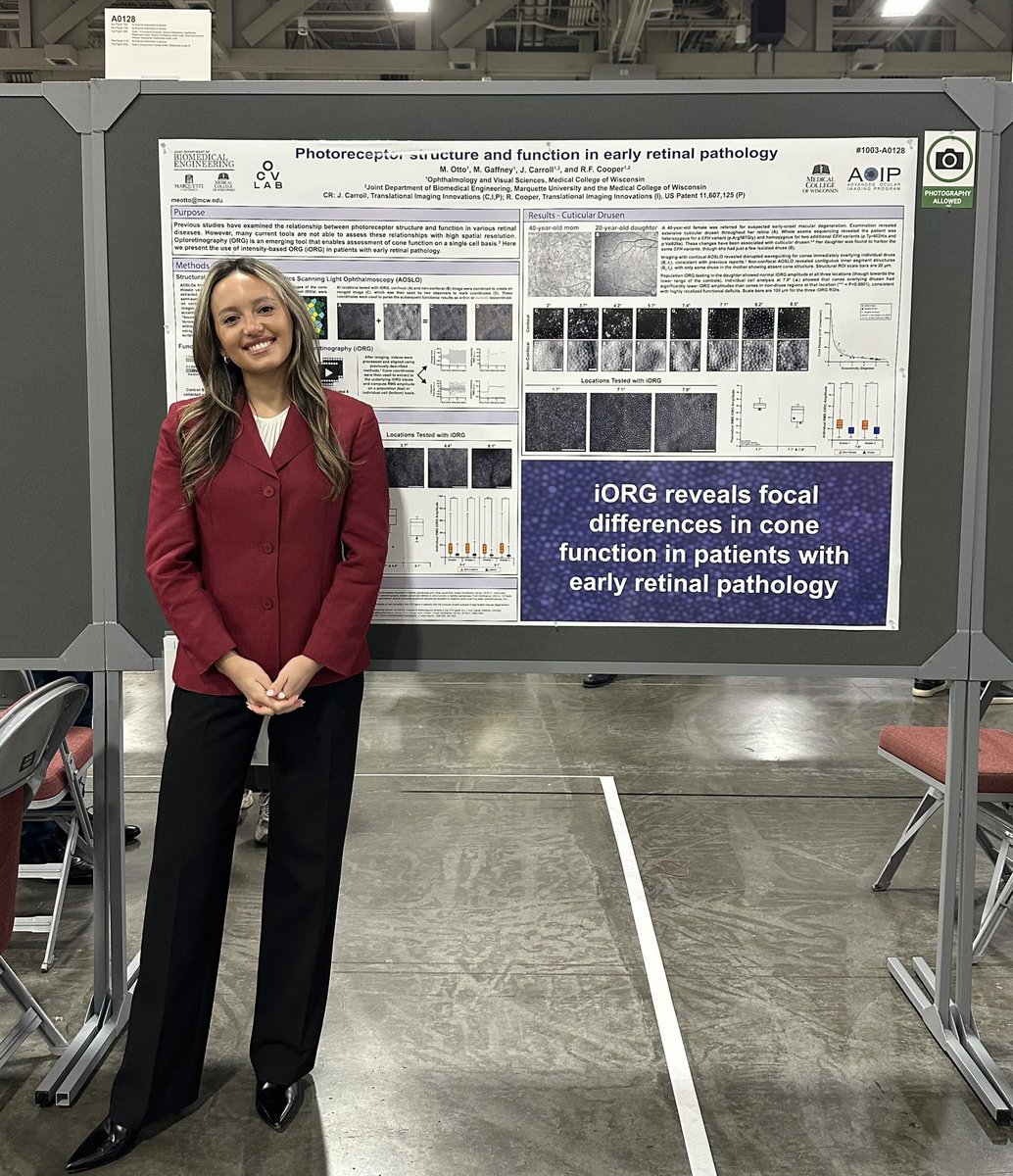 Come check out Megan’s @arvoinfo poster (A128) at 3:15pm-iORG based measures of cone function in patients with early retinal pathology. #ARVO2025