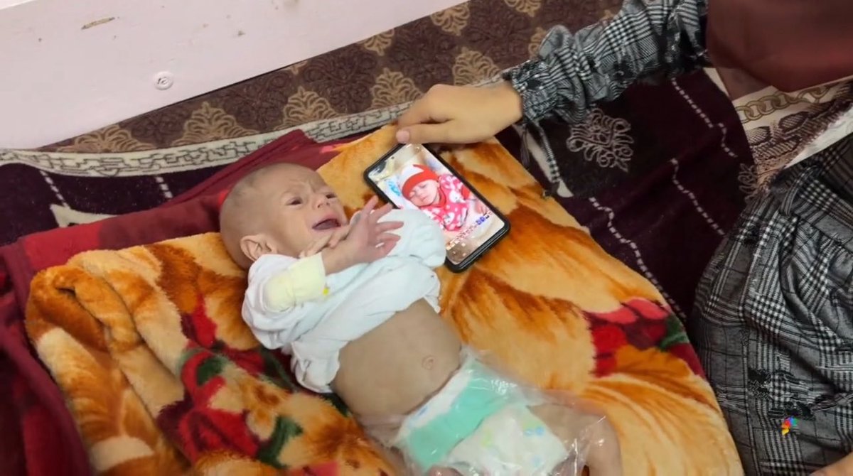 AssalRad's tweet photo. “Starve Away,” says a U.S. representative. https://t.co/ck0cm39SQz