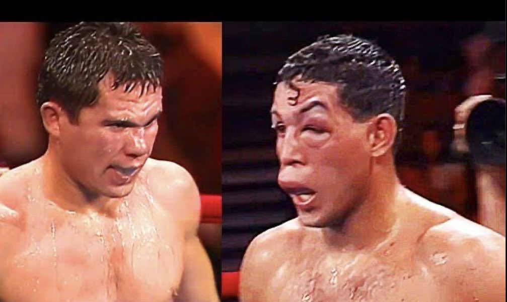 DavidFaitelson_'s tweet photo. De ninguna forma comparo al cubano Scull con aquel maravilloso Héctor “El Macho” Camacho, pero esto es justamente lo que se hace cuando un rival sale a correr y a rehusar el combate.
Cada noche, la figura de Julio César Chávez @Jcchavez115 se acrecienta como el más grande en la historia del boxeo mexicano…