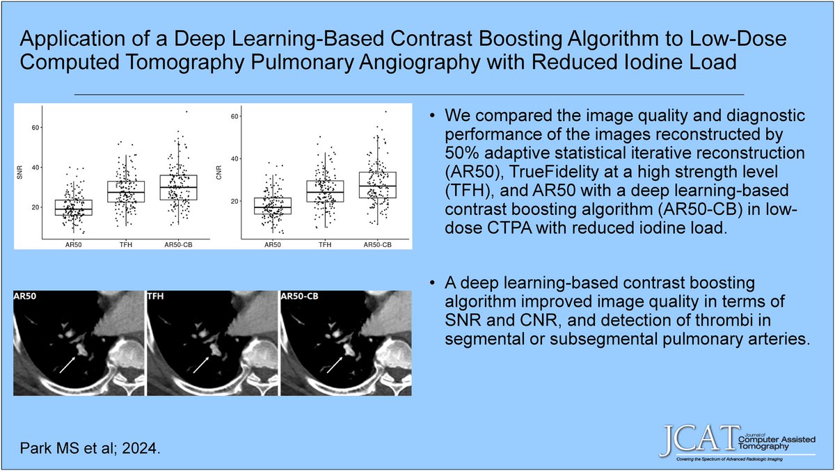 ETammMD's tweet image. "New @JCATonline
'Application of a Deep Learning–Based Contrast-Boosting Algorithm to Low-Dose Computed Tomography Pulmonary Angiography With Reduced Iodine Load'
Mar/Apr 2025 dlvr.it/TK5DZJ Au: Minsu Park et al. @PNUYH 
#CTAngiography #lung #CT