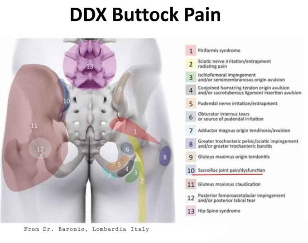 Causes of literal pain in rear