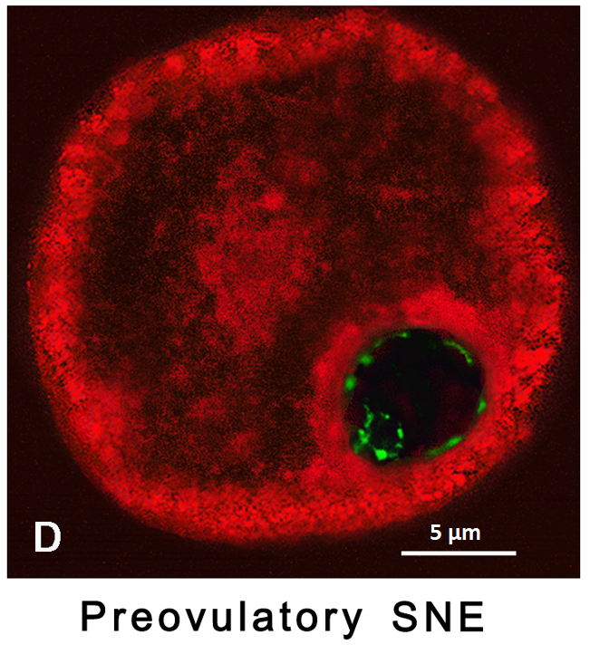 MarcosArrut's tweet photo. Does mitochondrial dysfunction cause aging? No. And here's why.

One of the most widespread theories of aging holds that mitochondria—the cell’s power plants—deteriorate over time, and that this deterioration is the fundamental cause of aging. The basis of this hypothesis is that, while producing energy, mitochondria also generate reactive oxygen species (ROS), molecules that can damage DNA. From this perspective, the gradual accumulation of such damage would lead to organismal aging.

However, when we examine this theory more closely, inconsistencies emerge that seriously challenge its validity. One of them appears at a critical moment in human development: conception.

During fertilization, when the sperm fuses with the oocyte to form the zygote, the mitochondria inherited by the new organism come exclusively from the oocyte. In other words, the mitochondria of the zygote—and thus of every human being—are entirely maternal in origin.

Now, if aging were caused by the accumulation of mitochondrial damage, we would expect babies to be born already aged. Why? Because, by the time of conception, the mother already exhibits mitochondrial damage in their cells—including their oocytes. Therefore, if aging resulted from deteriorated mitochondria, a child would inherit aged mitochondria and be born biologically old.

But that’s not what happens. Babies, even those born to older mothers, possess fully functional mitochondria, healthy metabolism, and an age of zero. This observable and verifiable fact directly contradicts the notion that aging stems from accumulated mitochondrial damage.

Nonetheless, this theory has contributed to the rise of antioxidant-based interventions, aiming to counteract the oxidative stress associated with aging. Yet after decades of research, experimental evidence has failed to show that antioxidants produce significant increases in lifespan, whether in humans or in animal models.

Some antioxidant compounds, such as astaxanthin, have shown positive effects in various studies, but not because they neutralize reactive oxygen species. Their efficacy lies in their ability to modulate key regulatory pathways involved in longevity—such as FOXO3, SIRT1, and Klotho—and to enhance autophagy through the regulation of AMPK, PI3K/Akt, and MAPK (JNK and p38). In other words, their benefits stem from functional gene modulation, not from their antioxidant activity.

Still, the antioxidant market continues to grow. In 2024, it was valued at $4.84 billion, and it's projected to reach $7.64 billion by 2032. The only thing that doesn’t seem to age is the business behind it.

So what’s the point of all this? That aging is not an inevitable consequence of cumulative damage, but a biologically regulated process. Each cell carries the instructions to remain young—but over time, those instructions are progressively silenced. Mounting evidence points to an epigenetic origin of aging: a program, deeply embedded in the genome, that gradually shifts gene expression, disrupts cellular function, and leads to tissue decline.

Understanding this is not just a scientific milestone—it’s a call to action. Because if aging is programmed, then it can be reprogrammed. And that is exactly what we intend to do.

That's all.
