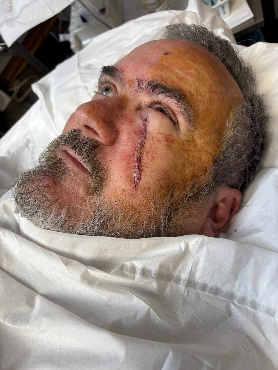 Mr_Pendulum_'s tweet image. PLEASE CONSIDER HELPING MY DAD 

Link: gofund.me/5993afad 👈🏻

He’s provided his entire life for his family and it’s the least I could do to set this up and maybe alleviate the pain by helping with bills and some extra cash in general. If any man deserves your help it’s this