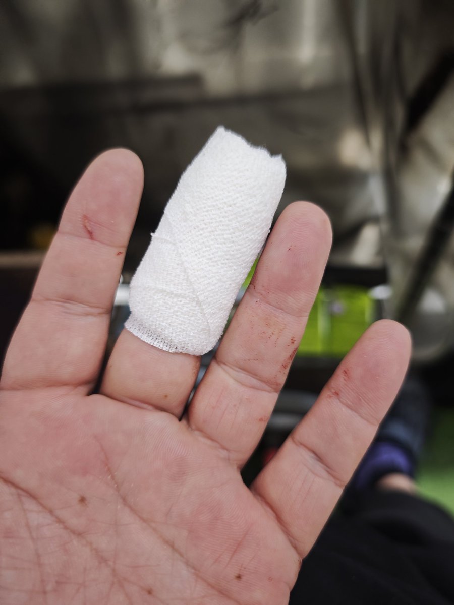 昨日の午後に角材で指を切った…大量に出血したけど、日曜日だったし、すぐ治まるだろうと思って絆創膏で止血…
今朝絆創膏剥がしたら、出血止まらず、医者行ってきたら全治一ヶ月らしい😱
暫くドラム叩けん😭