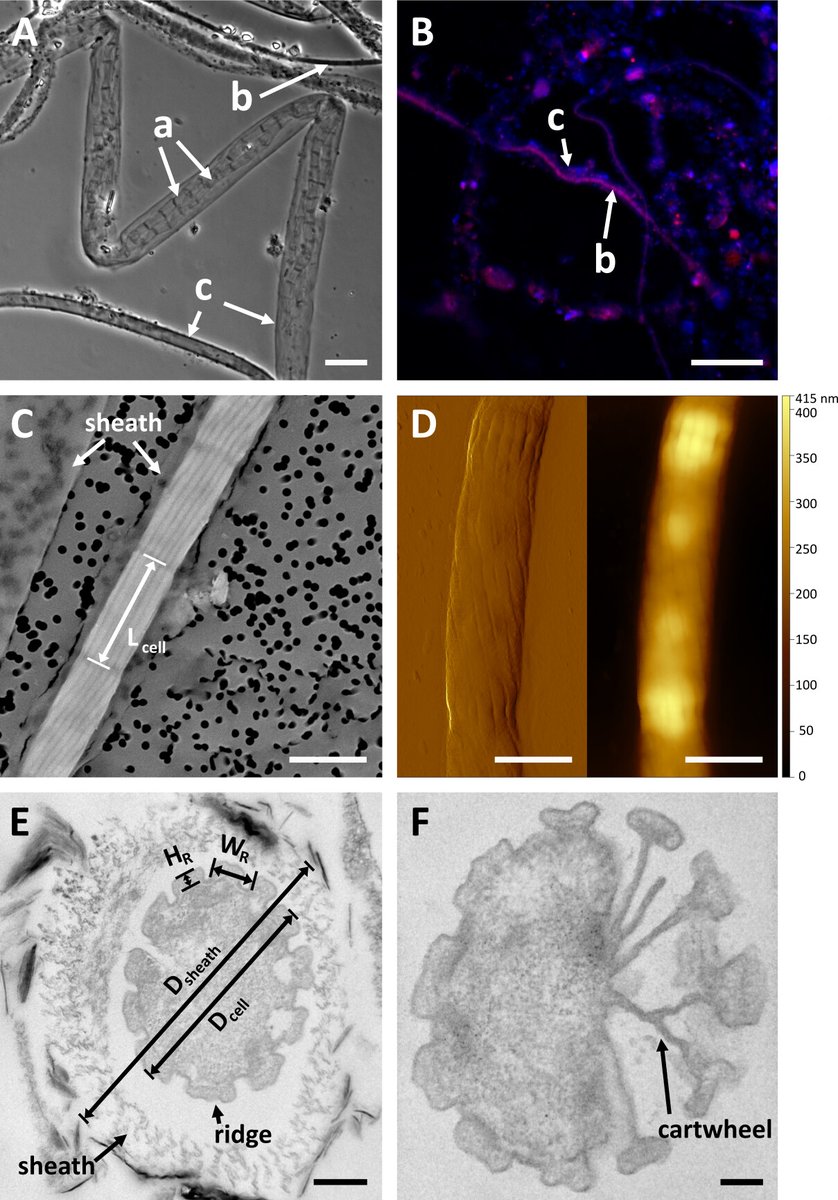 A novel cable bacteria species with a distinct morphology and genomic potential
#microbiology #bacteria
<a href="/ASMicrobiology/">ASM</a> <a href="/AppEnvMicro/">AppEnvMicro journal</a> 
journals.asm.org/doi/10.1128/ae…