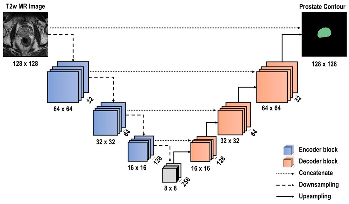 Bioeng_MDPI's tweet photo. ๐ฌ Excited to share the publication "U-Net Architecture for Prostate Segmentation: The Impact of Loss Function on System Performance". Access the full article freely here ๐ https://t.co/Ht0ITqLRYV
#prostate #cancer #segmentation #U_Net #mp_MRI #loss_function #medical_imaging https://t.co/knwXBVxaPJ