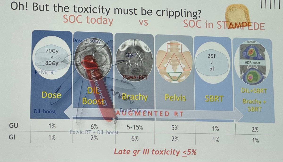 Stefano Arcangeli (@star_mcm74) on Twitter photo 🚀 oustanding presentation by <a href="/VedangMurthy/">Vedang Murthy</a> showing that #AUGMENTED RT ⬆️ outcomes with extremely limited tox in high-risk PCa
#ESTRO2025 🚀 oustanding presentation by <a href="/VedangMurthy/">Vedang Murthy</a> showing that #AUGMENTED RT ⬆️ outcomes with extremely limited tox in high-risk PCa
#ESTRO2025