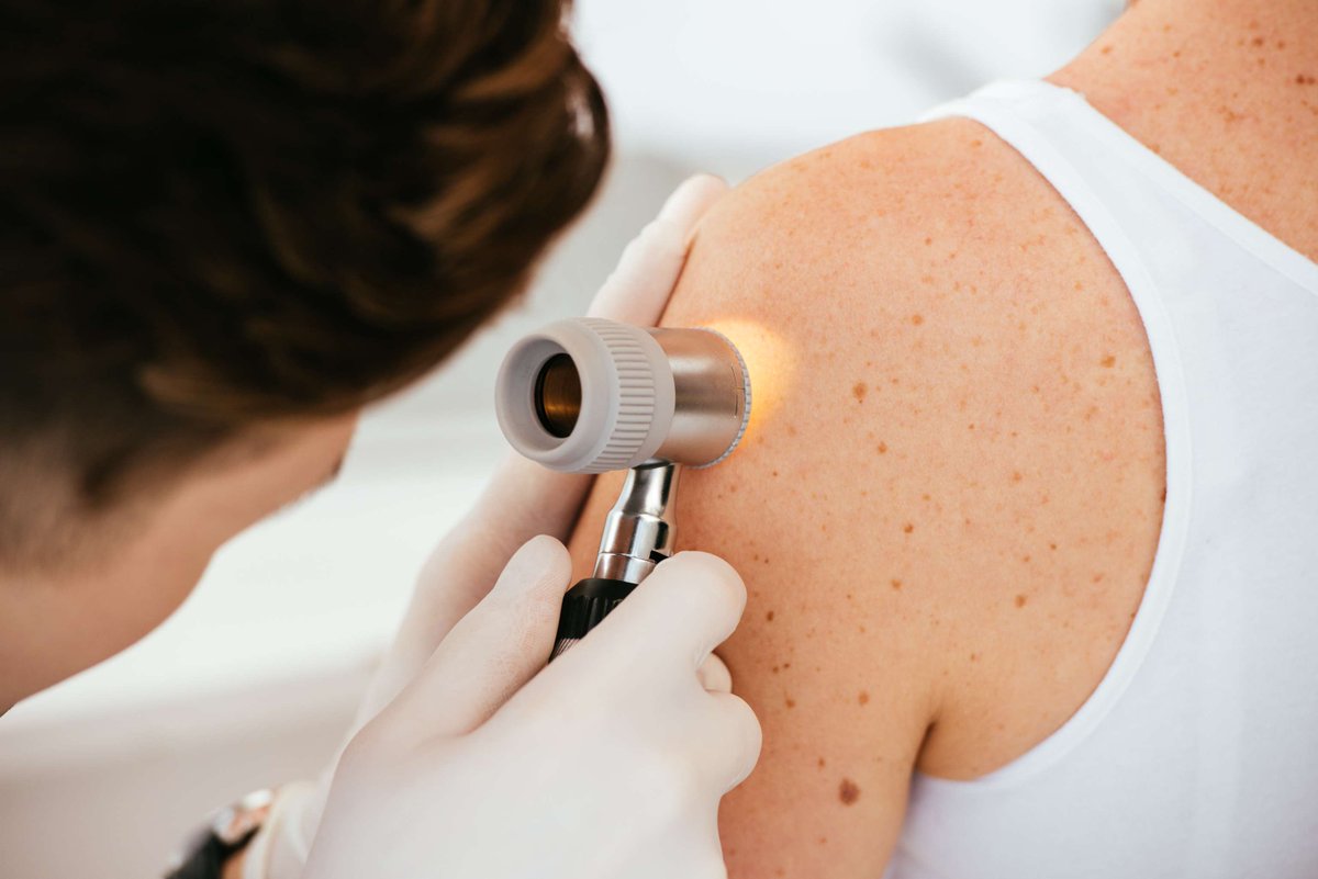 Research led by Tiffany Libby, clinical assistant professor of #Dermatology, shows that #Metformin, a diabetes drug, may significantly lower the risk of basal &amp; squamous cell skin cancers.

Read more: ow.ly/pAic50UKs7p

#SkinCancer #ResearchMatters