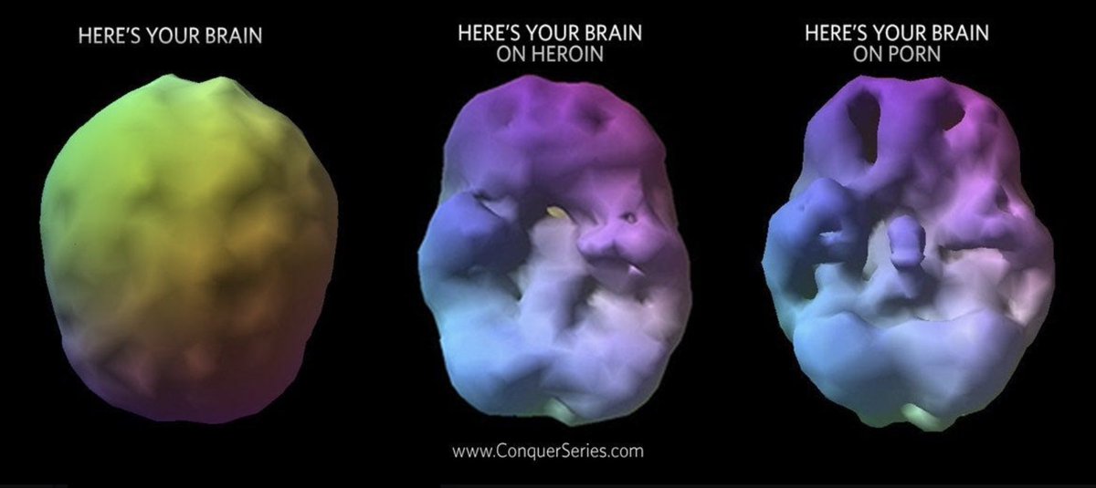 nofap_guru's tweet image. The differences between a porn and a drug addicts  brain

No differences

I hope you choose the right path

Retain and get a healthy brain

#nofap #semenretention