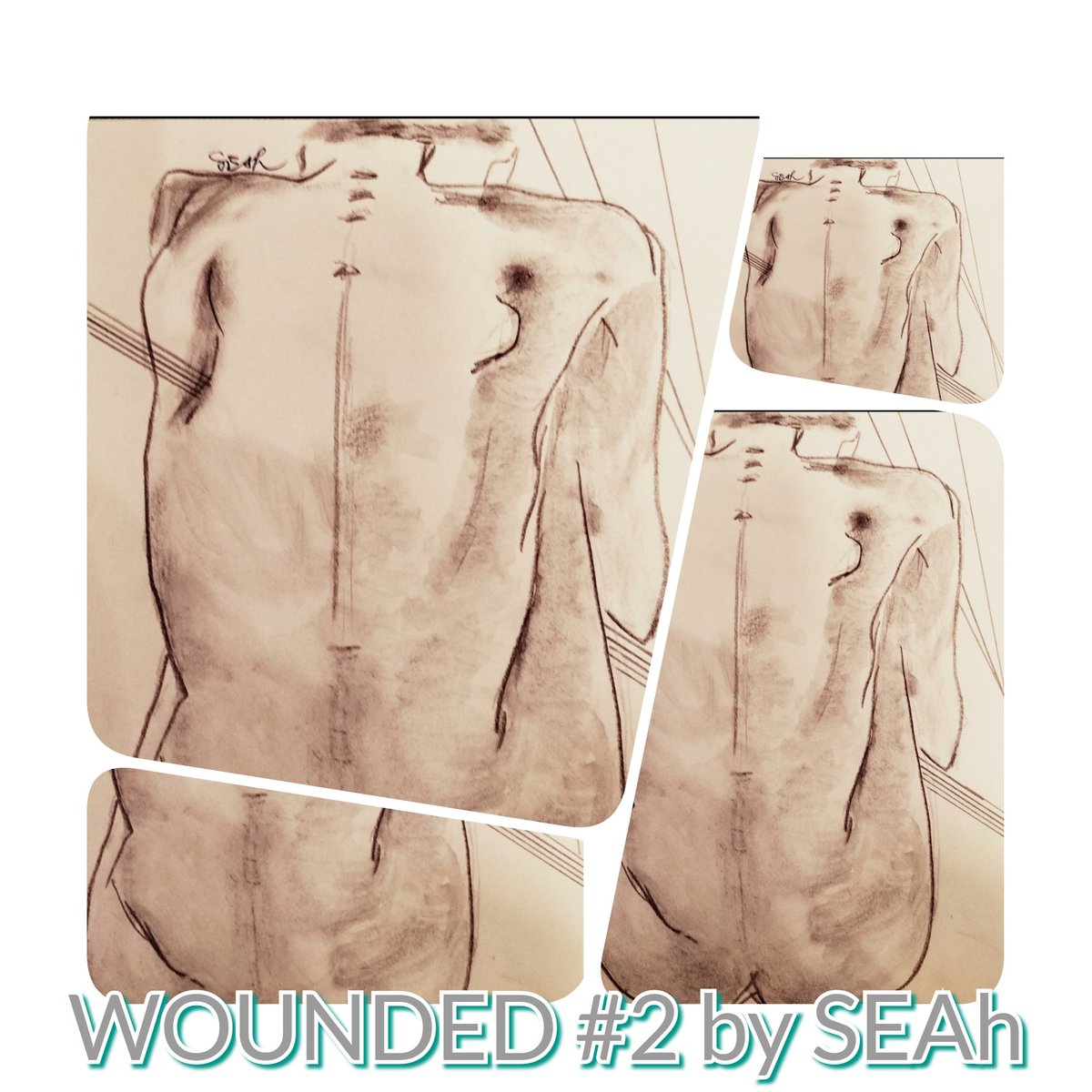 Wounded series
