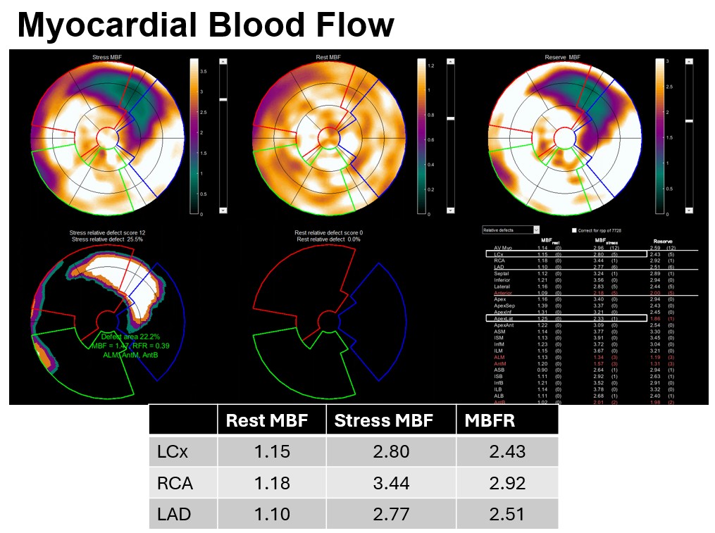 New #CVNuc #ThinkPET case poll:  69-year-old male with known CAD and chest pain underwent adenosine 15O- H2O PET. What is your interpretation? Vote below.