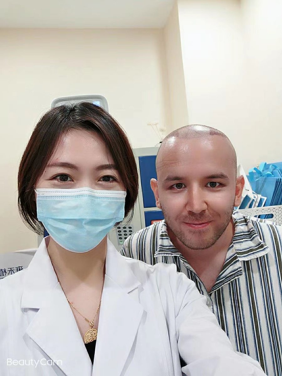 rain79050853's tweet photo. M-shaped hair loss is finally gone~waiting for hair growth
-
Consult me ​​about hair transplantation:             
WeChat: yhzfyl2005              
WhatsApp consultation: https://t.co/7Df8roApcx 
#hairtransplant #hairloss #thinninghair #yonghe #Malebaldness #hairstyle #hairgrowth #Hair