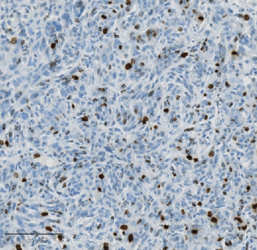 CSIC (@csic) on Twitter photo 🦠 La duración de la división celular es un marcador clave para la susceptibilidad al cáncer
🔬 El <a href="/ciccancer/">Centro de Investigación del Cáncer/CSIC-USAL-FICUS</a> participa en un estudio que desafía la visión tradicional sobre cómo y por qué las células con mutaciones cancerígenas llegan a formar tumores
➡️tinyurl.com/277d33w6 🦠 La duración de la división celular es un marcador clave para la susceptibilidad al cáncer
🔬 El <a href="/ciccancer/">Centro de Investigación del Cáncer/CSIC-USAL-FICUS</a> participa en un estudio que desafía la visión tradicional sobre cómo y por qué las células con mutaciones cancerígenas llegan a formar tumores
➡️tinyurl.com/277d33w6