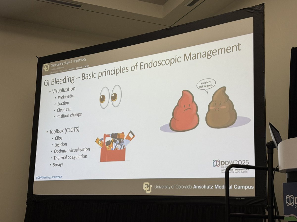 MN_GIMD's tweet photo. Getting me things with @BilalMohammadMD “GI Bleeding:
New Tools” 

⭐️ Visualization is key (prokinetics, clot suctioning devices, power irrigators & change in patient position ⬇️) 

Fellows think about clearing the BIG 4:
⭐️ GE jxn / Fundus / Antrum / Bulb

⭐️ Data for OTSC clips - does not need to be rescue therapy & can be primary modality 

@DDWMeeting #DDW2025