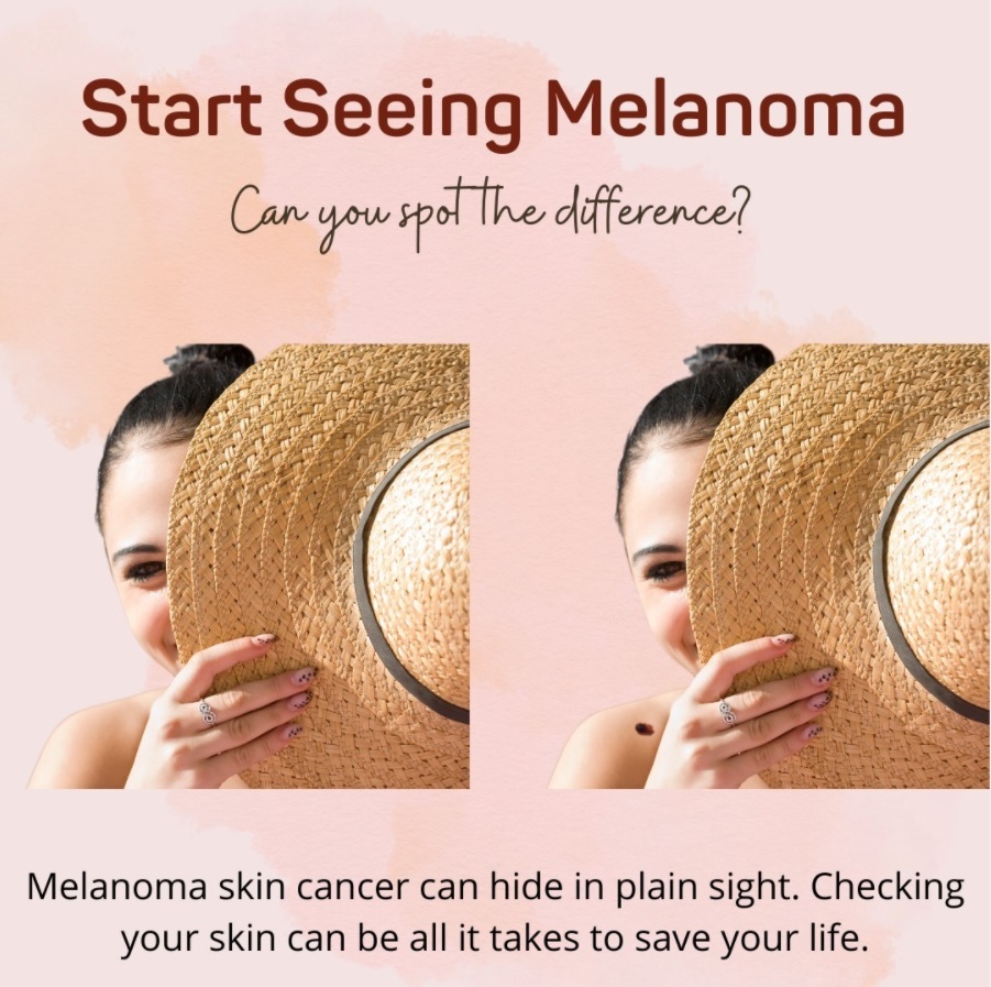 Today is #MelanomaMonday: Sometimes a simple skin check can save your life.*  
DermaSensor's FDA Cleared device uses spectroscopy &amp; AI to help clinicians assess suspicious skin lesions at point of care. 
*Visit hubs.li/Q03l1rcr0
 #SkinCheck #Melanoma #CancerPrevention