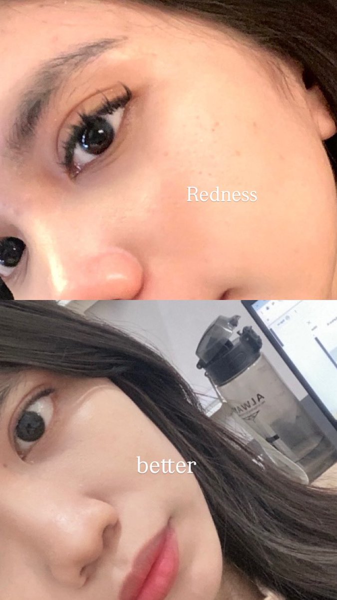yiesyah1's tweet image. kenapa ga pake moist ini dr dulu sii 😭 

ngelembabin nya depet, cerah in muka juga oke ❤️✨

A thread 

#reviewbyynfa