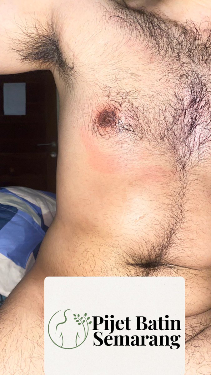 Pijat Batin Semarang 🔔 tweet media