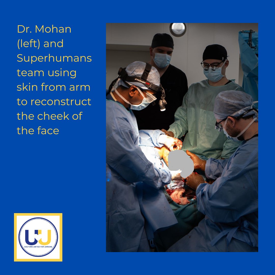DoctorsU4U's tweet photo. Dr. Suresh Mohan (DU4U member and Surgeon at Yale) is working with Ukrainian colleagues from Superhumans on facial reconstruction that preserves nerves and blood vessels of people whose faces were ravaged by war. Thank you to Superhumans, @GuthrieClinic @YalePCCSM  @Yale_ENT https://t.co/UN7s9bOyaC