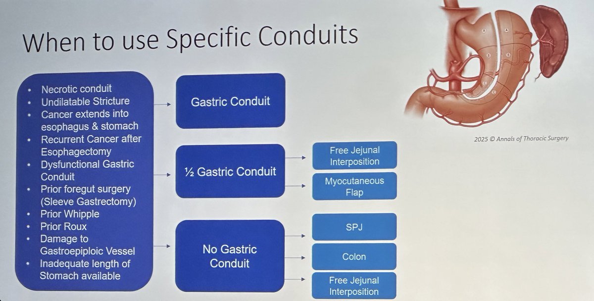 Crystal Zhang, MD, MPH (@crystalzhangmd) on Twitter photo The final day of #AATS2025 starts off with Dr. <a href="/ShandaBlackmon/">Shanda Blackmon, MD, MPH</a> sharing her wealth of knowledge and experience in managing gastric conduit leaks and options for complex esophageal reconstruction <a href="/BCM_Surgery/">BCM_Surgery</a> <a href="/WomenInThoracic/">WomenInThoracicSurg</a> <a href="/AATSHQ/">AATS</a>
annalsthoracicsurgery.org/article/S0003-… The final day of #AATS2025 starts off with Dr. <a href="/ShandaBlackmon/">Shanda Blackmon, MD, MPH</a> sharing her wealth of knowledge and experience in managing gastric conduit leaks and options for complex esophageal reconstruction <a href="/BCM_Surgery/">BCM_Surgery</a> <a href="/WomenInThoracic/">WomenInThoracicSurg</a> <a href="/AATSHQ/">AATS</a>
annalsthoracicsurgery.org/article/S0003-…