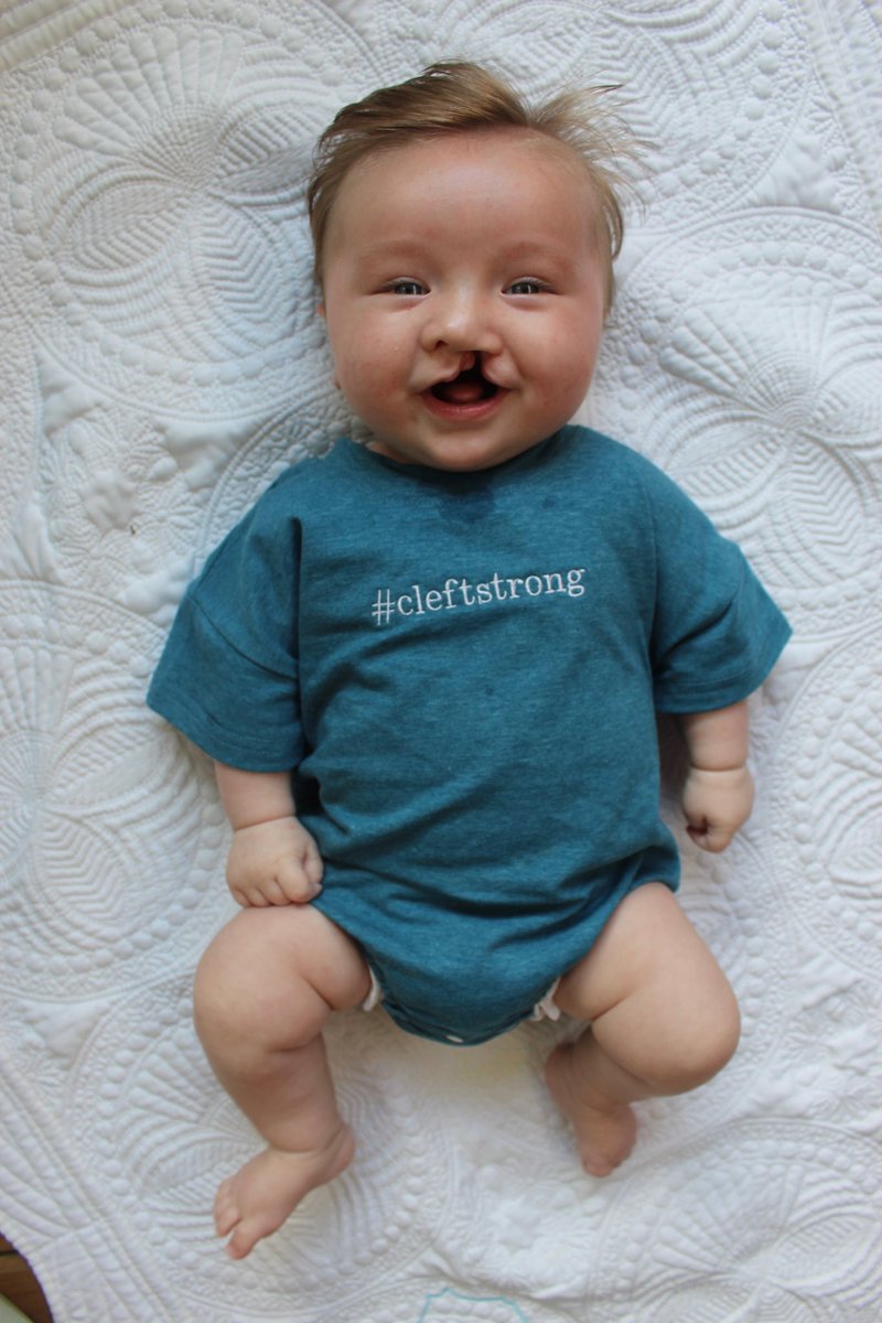 Today's the day! Taking our guy in for the first of several surgeries.

I'm truly thankful for Henry's medical team, our supportive family, and my remarkable wife for taking the lead caring for our son.