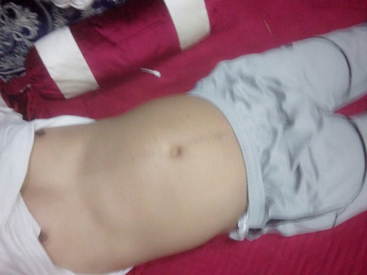 اسمر جميل (@anormslm1) on Twitter photo 