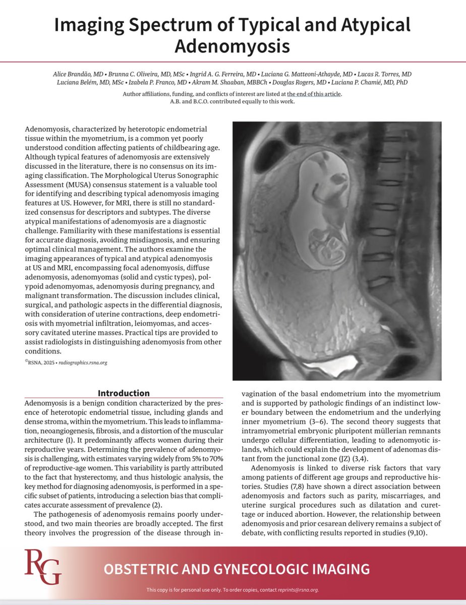 luciana@chamie.com.br (@lucianachamiec1) on Twitter photo I’m pleased to share with you our new publication in RadioGraphics on the imaging features of adenomyosis, including typical and atypical imaging appearances at US and MRI <a href="/RSNA/">RSNA</a> <a href="/RadioGraphics/">RadioGraphics</a> <a href="/cookyscan1/">Cooky Menias</a> I’m pleased to share with you our new publication in RadioGraphics on the imaging features of adenomyosis, including typical and atypical imaging appearances at US and MRI <a href="/RSNA/">RSNA</a> <a href="/RadioGraphics/">RadioGraphics</a> <a href="/cookyscan1/">Cooky Menias</a>