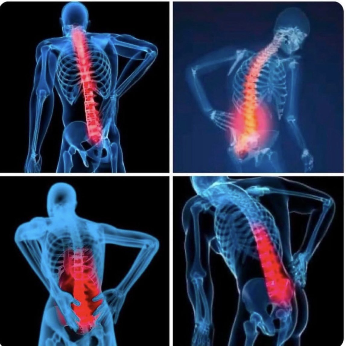 Naoya Inoue’s post fight X-Ray shows strain due to carrying the sport of boxing on his back for Cinco De Mayo weekend. #InoueCardenas #boxing