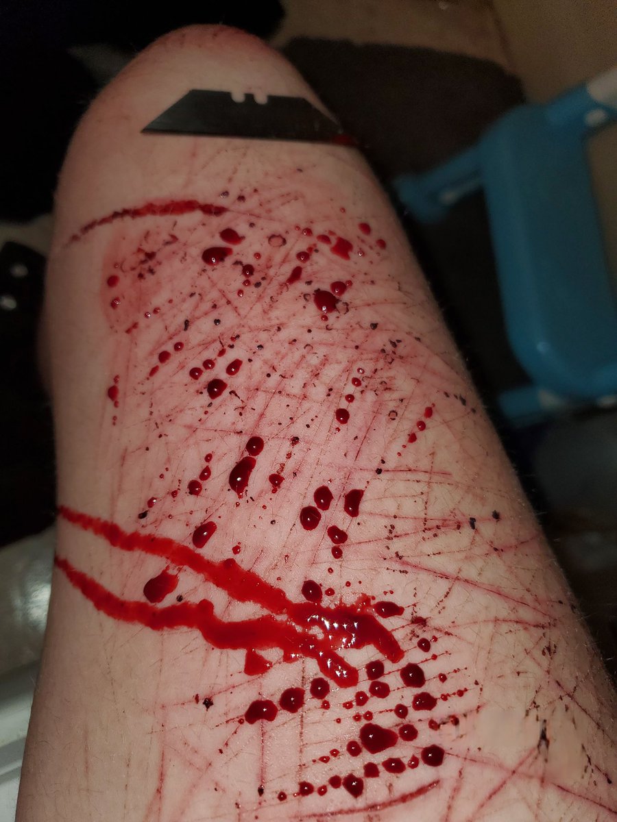 kLasmero_'s tweet photo. 🖤BLOODY CUTS!🖤

#shtwt #selfharm #shedtwt #goretwt https://t.co/RiUt1ENoIT