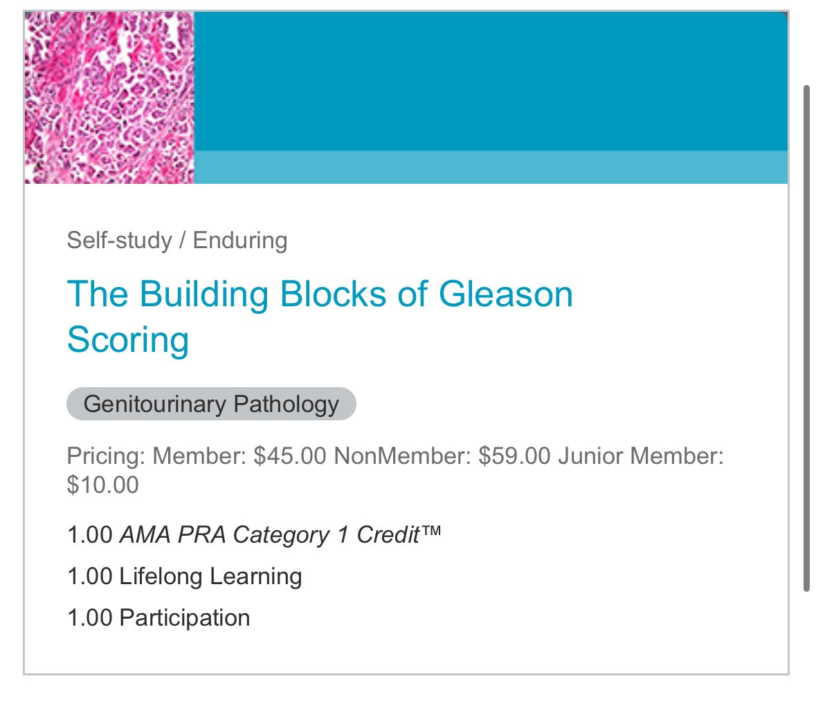 Gladell Paner, MD (@gladellpaner) on Twitter photo Iโm honored to co-author 2 CAP <a href="/Pathologists/">CAPathologists</a> Online Courses for #GUPath ๐๐ป
1st - Building Blocks of Gleason Scoring
1. Compare and contrast classical with ISUP & GUPS modified GS.
2. Contemporary GS in Bx & RP.
Big discount for junior members
๐๐๐
education.cap.org/content/buildiโฆ Iโm honored to co-author 2 CAP <a href="/Pathologists/">CAPathologists</a> Online Courses for #GUPath ๐๐ป
1st - Building Blocks of Gleason Scoring
1. Compare and contrast classical with ISUP & GUPS modified GS.
2. Contemporary GS in Bx & RP.
Big discount for junior members
๐๐๐
education.cap.org/content/buildiโฆ