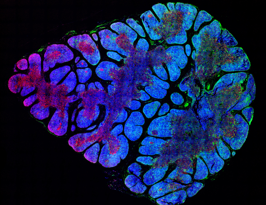 Science Immunology (@sciimmunology) on Twitter photo Scientists have shown that type I and type II #interferons shape the formation of #thymic epithelial cells in the thymic medulla and cortex during early human development. <a href="/StanfordPeds/">Stanford Pediatrics</a>
Learn more in Science #Immunology: scim.ag/3Yobod7 Scientists have shown that type I and type II #interferons shape the formation of #thymic epithelial cells in the thymic medulla and cortex during early human development. <a href="/StanfordPeds/">Stanford Pediatrics</a>
Learn more in Science #Immunology: scim.ag/3Yobod7