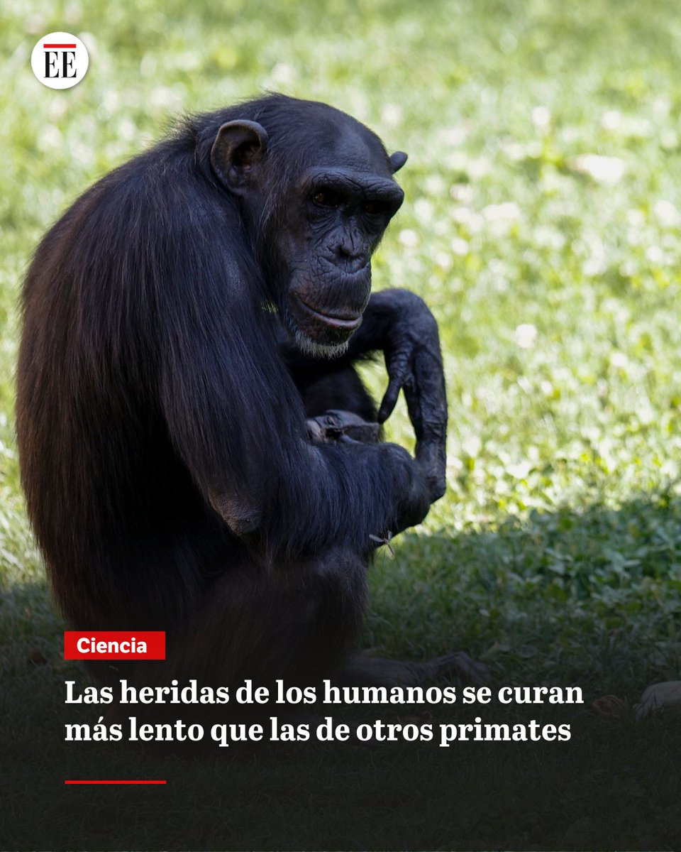 ¿A qué se debe? Esta es la hipótesis. 👉 trib.al/xnYi0PU