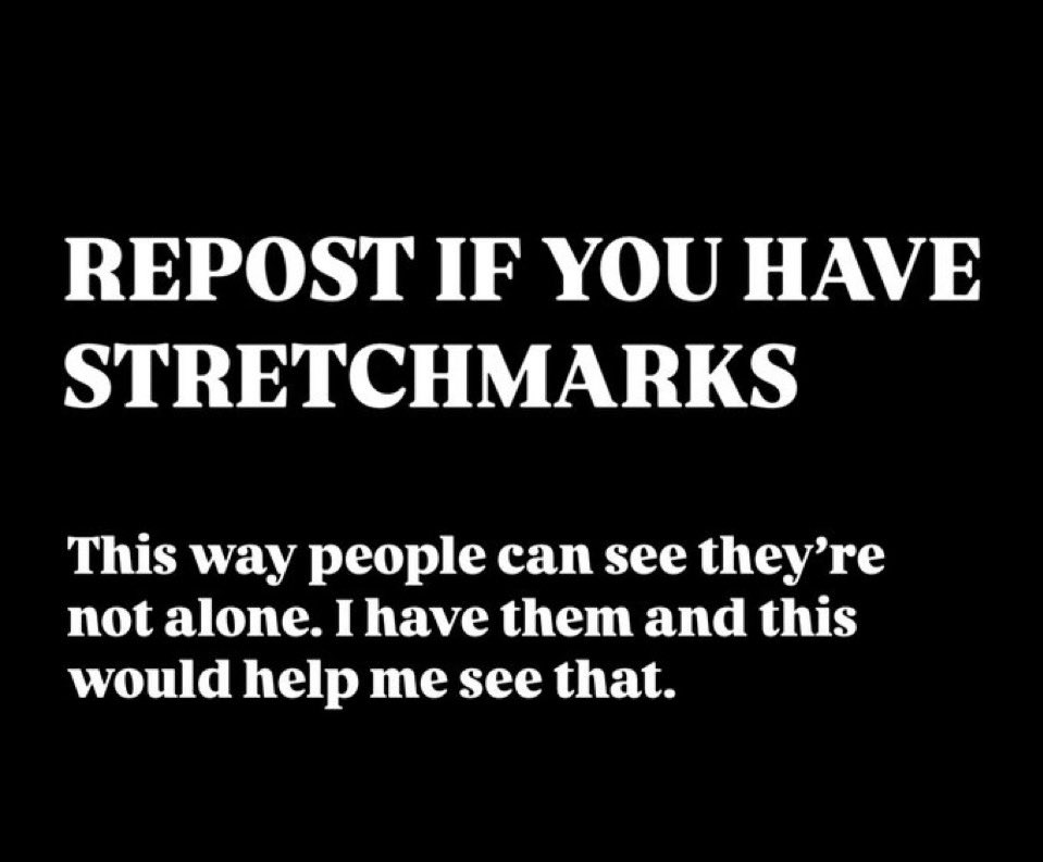 It was my biggest insecurity. Now, I love them and they make me feel hot.
Stretchmarks shouldn’t be something we shame, it’s a natural thing.
Stretchmarks happen when you’re growing and your body can’t produce skin cells fast enough to keep up with said growth
They.
Are.
Natural.