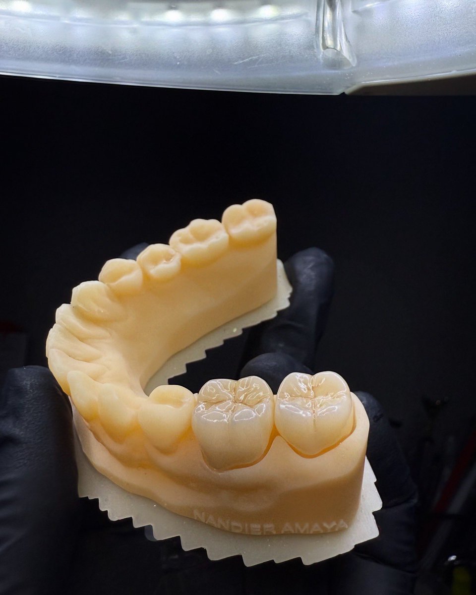 dentallab_'s tweet photo. 🦷✨ https://t.co/LuY4u4oDOY