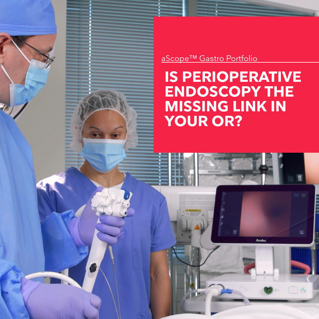 AmbuUSA's tweet image. Is your OR missing a game-changer? Perioperative endoscopy can improve outcomes &amp;amp; streamline workflows — but many ORs aren’t leveraging its full potential. With Ambu’s single-use gastroscopes, integration is seamless.

Find out more: 
ow.ly/iXTe50VjRQx

#endoscopysolutions