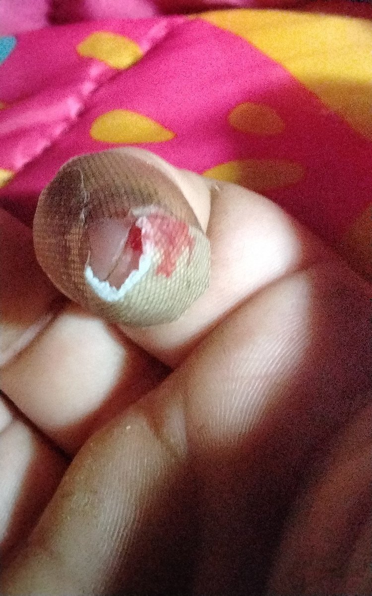 FUCK TRYING TO GET BLADES OUTTA THEIE SHIT )):