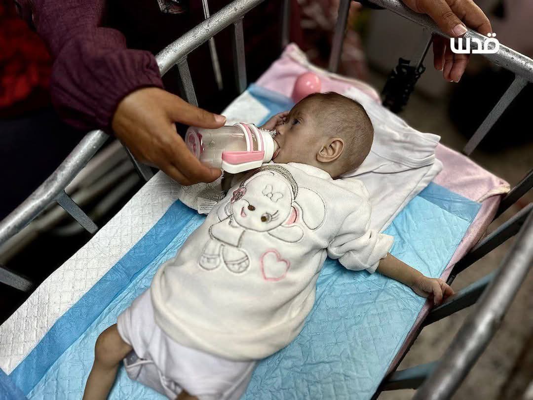 Nasem0n's tweet image. Malnourished children receive medical care at Nasser Hospital in Khan Yunis, as shortages of essential medicines and food continue due to the Israeli closure of crossings and the tightening of the siege on the Gaza Strip.