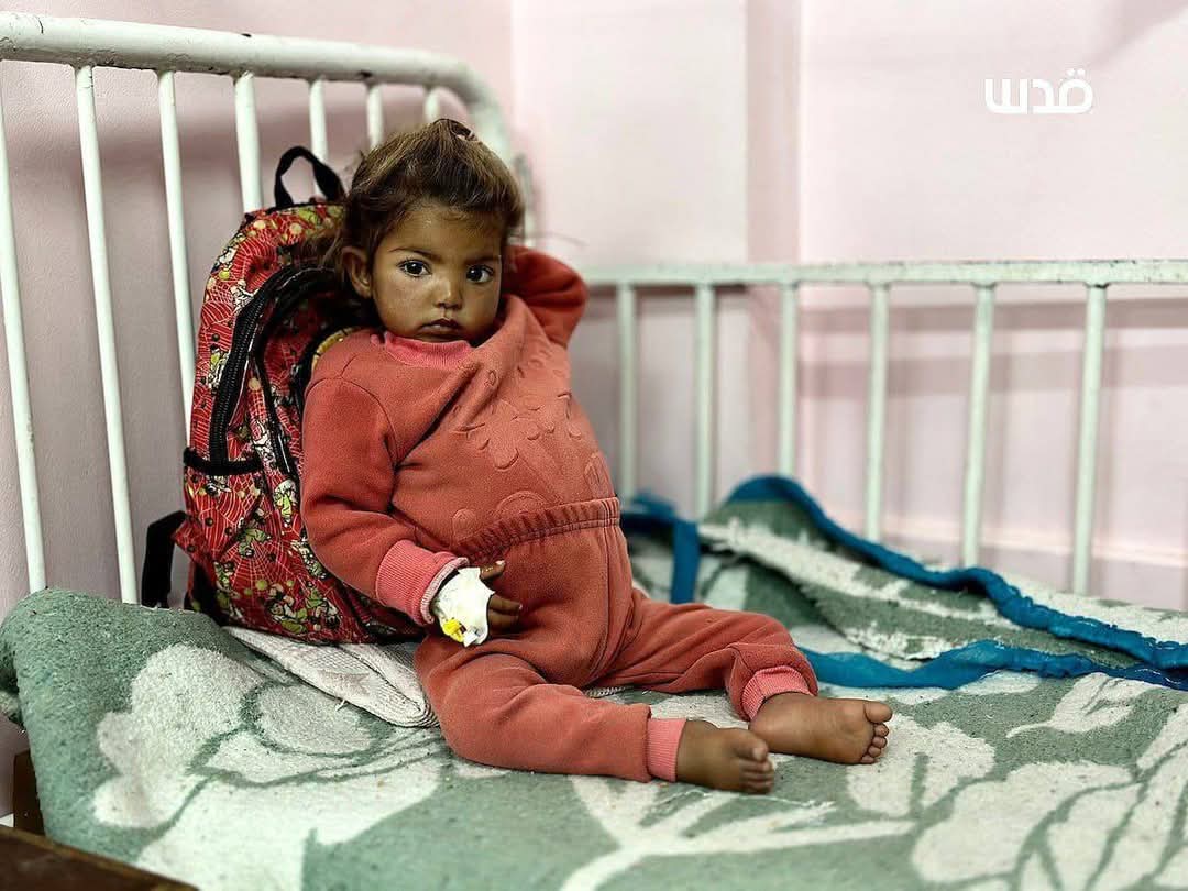 Nasem0n's tweet image. Malnourished children receive medical care at Nasser Hospital in Khan Yunis, as shortages of essential medicines and food continue due to the Israeli closure of crossings and the tightening of the siege on the Gaza Strip.
