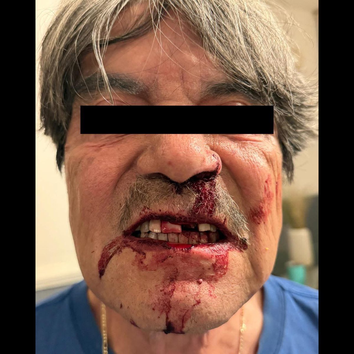 edgarfabianvf's tweet photo. Un hombre denunció que su padre, un científico de la tercera edad, fue golpeado por un ciudadano francés identificado como Jean-Phillipe, en el Campo de Golf Santa Margarita, en Irapuato. 
El ataque ocurrió luego de que la perrita del adulto mayor se acercara a la propiedad del agresor durante una fiesta. 
El padre fue  golpeado en el suelo, sufriendo graves lesiones. 
El agresor además amenazó con matarlo. La familia exigió  justicia y castigo. https://t.co/3g7nXQi44x