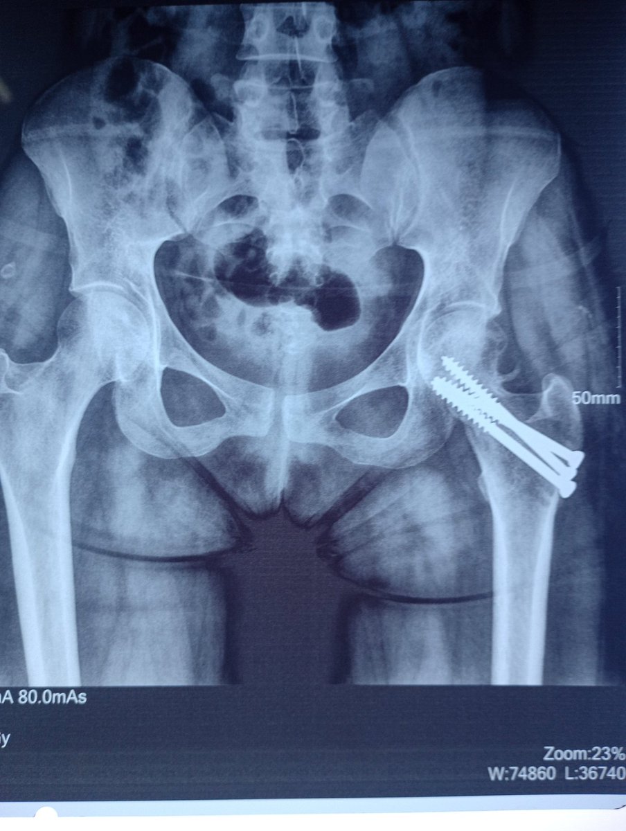 Tailored Individualised Solutions