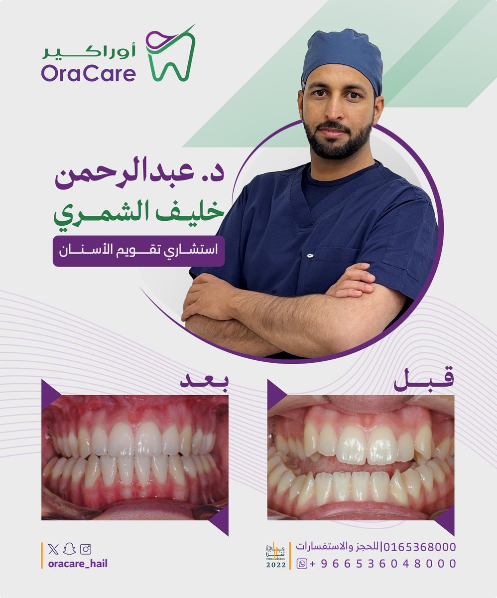 OraCare_Hail's tweet photo. في #اوراكير
نفخر بكوادرنا
د. عبدالرحمن خليف الشمري
استشاري تقويم الأسنان
#oracare
#الجودة_هدفنا https://t.co/lCWhlqX9FR
