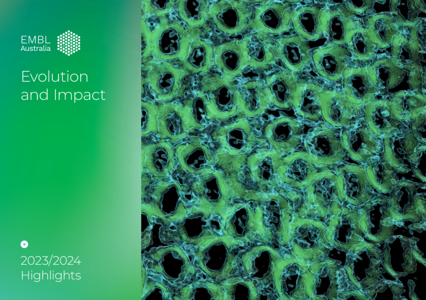 EMBL Australia (@emblaustralia) on Twitter photo ๐ข๐๐ฟ ๐ถ๐บ๐ฝ๐ฎ๐ฐ๐ ๐ถ๐ป ๐ป๐๐บ๐ฏ๐ฒ๐ฟ๐, ๐๐๐ผ๐ฟ๐ถ๐ฒ๐ ๐ฎ๐ป๐ฑ ๐๐ฐ๐ถ๐ฒ๐ป๐ฐ๐ฒ ๐ฌ
From expanding national research capacity to supporting the next gen of life science leaders, our report showcases the power of collaboration and innovation.
๐Read it: bit.ly/3EVhwD8 ๐ข๐๐ฟ ๐ถ๐บ๐ฝ๐ฎ๐ฐ๐ ๐ถ๐ป ๐ป๐๐บ๐ฏ๐ฒ๐ฟ๐, ๐๐๐ผ๐ฟ๐ถ๐ฒ๐ ๐ฎ๐ป๐ฑ ๐๐ฐ๐ถ๐ฒ๐ป๐ฐ๐ฒ ๐ฌ
From expanding national research capacity to supporting the next gen of life science leaders, our report showcases the power of collaboration and innovation.
๐Read it: bit.ly/3EVhwD8
