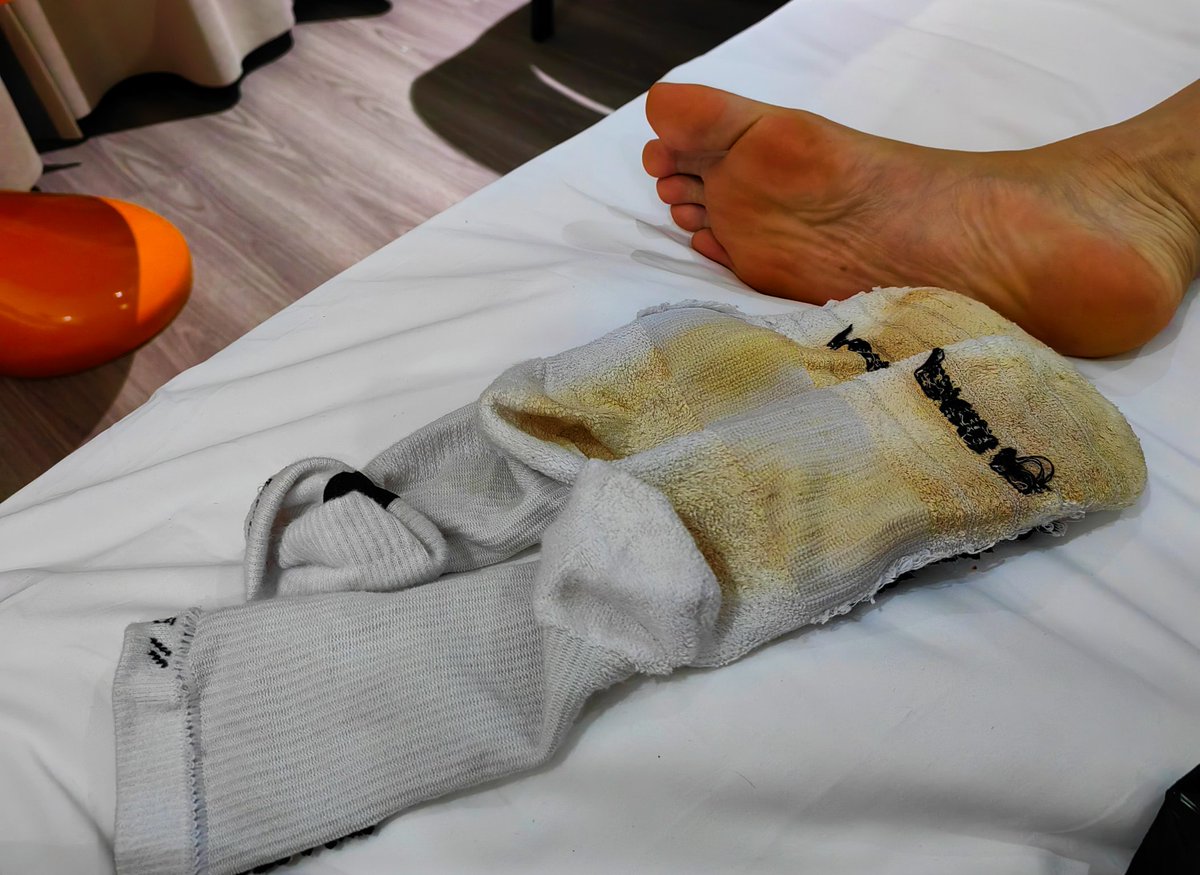 假期几天爆走造成这逼样