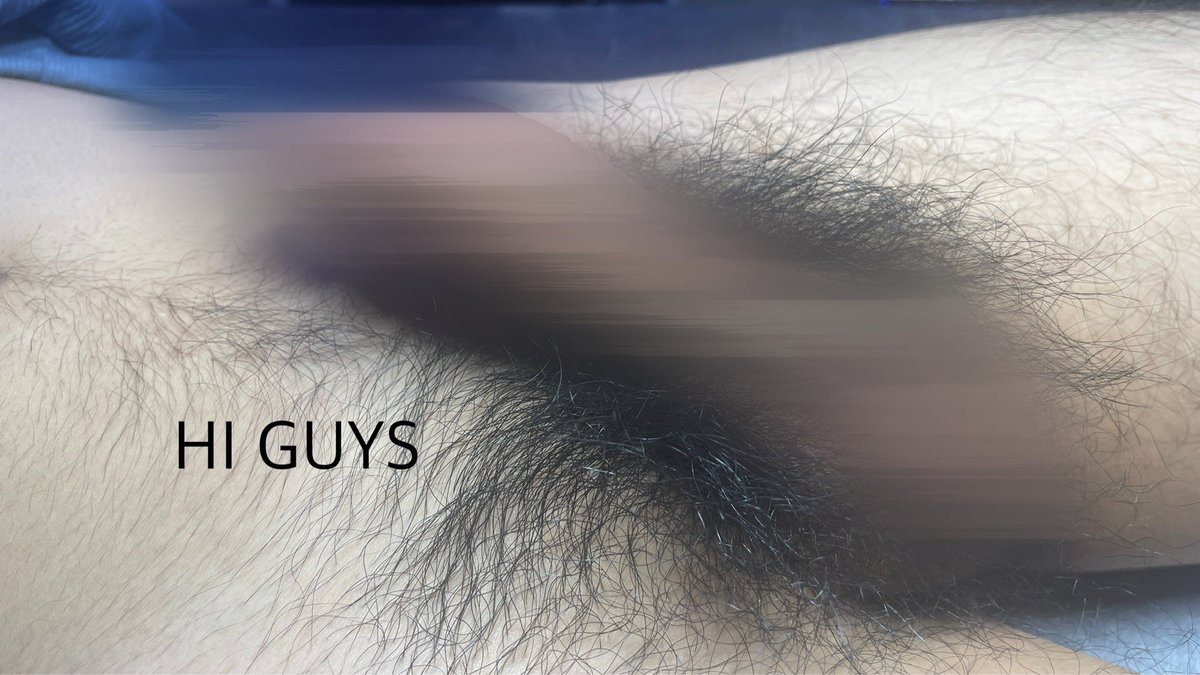 [하이가이즈 왁싱]

남자 브라질리언 왁싱(고급)

남성전용 왁싱 네이버예약⬇️
naver.me/GKUxX6OD

 #남자왁서 #남자왁싱 #남성전문왁싱샵 #군자왁싱 #건대왁싱 #하이가이즈왁싱 #남자브라질리언왁싱