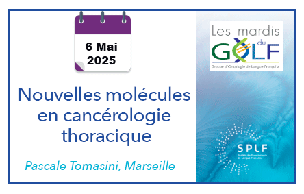 SPLF_SocPneumo's tweet image. Nouvelles molécules en cancérologie thoracique aujourd'hui dans le mardi du GOLF de la SPLF, série mensuelle consacrée à l'#oncologie #thoracique
A 13h : tinyurl.com/4egpp33o
+ tard en replay/ podcast et version audio : tinyurl.com/13417pjv
#respiration #cancer #pneumologie