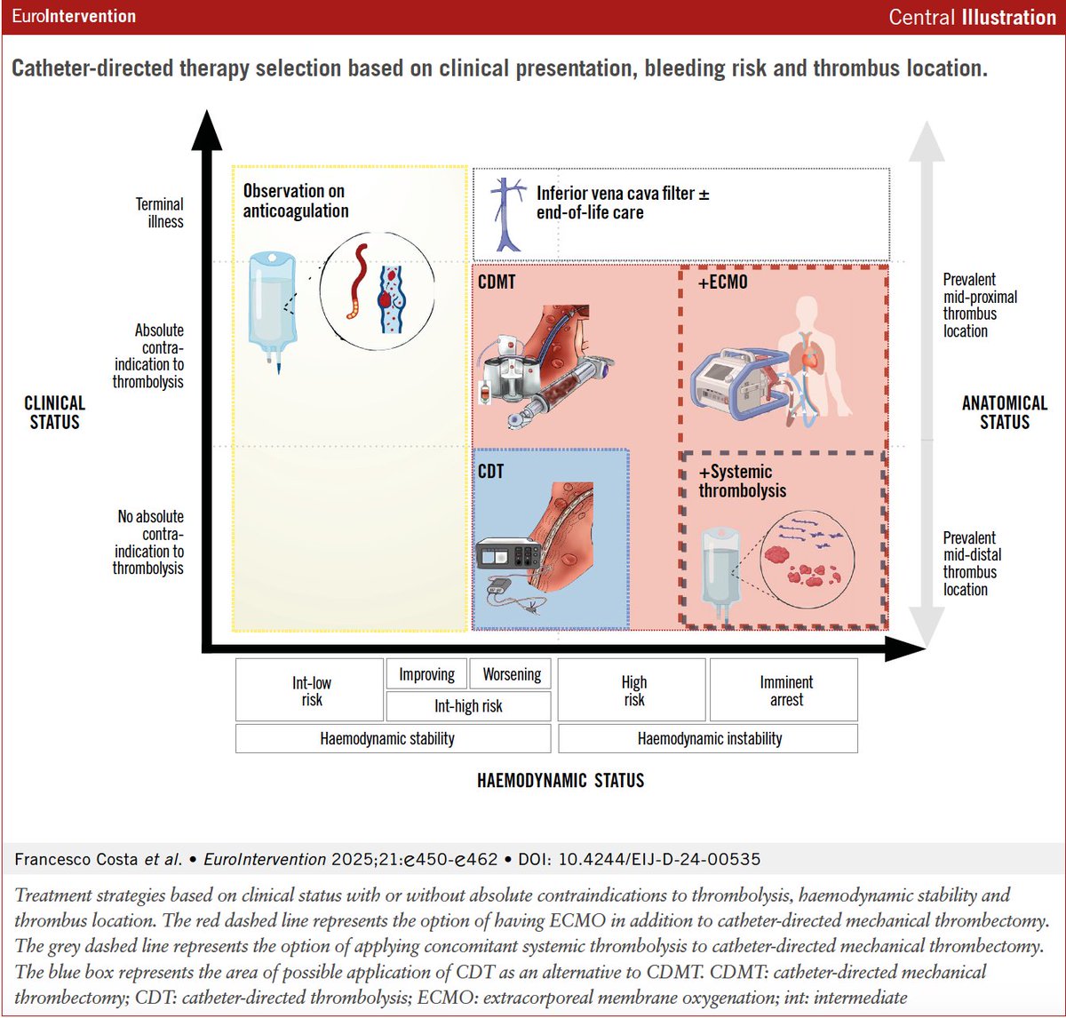 EuroIntervention (@eurointerventio) on Twitter photo 🔥Just published🔥
"Catheter-based techniques for pulmonary embolism treatment" by <a href="/Costa_F_8/">Francesco Costa</a>, <a href="/MicariAntonio/">Antonio micari</a> et al.
✅A detailed review on CDT & CDMT
✅Practical strategies for device selection, procedural planning & risk stratification
✅Insights from the PEERLESS trial
🔗 🔥Just published🔥
"Catheter-based techniques for pulmonary embolism treatment" by <a href="/Costa_F_8/">Francesco Costa</a>, <a href="/MicariAntonio/">Antonio micari</a> et al.
✅A detailed review on CDT & CDMT
✅Practical strategies for device selection, procedural planning & risk stratification
✅Insights from the PEERLESS trial
🔗