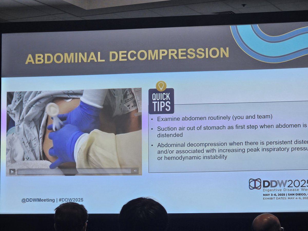 zubairkhan254's tweet photo. @DennisYangMD sharing his tips for a successful POEM.
#POEM
#Thirdspaceendoscopy
#DDW2025
#CIEAdevnthealth https://t.co/tH0rEvdCBr
