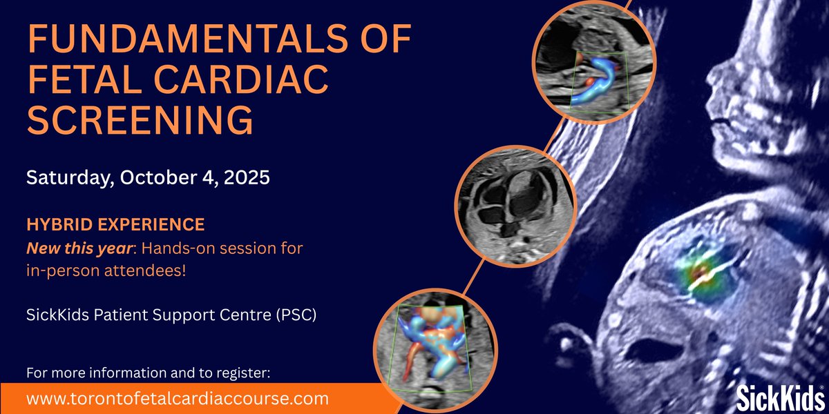 SickKids Labatt Family Heart Centre (@skheartcentre) on Twitter photo 🌟Join us for Fundamentals of Fetal Cardiac Screening! A 1-day course with lectures, interactive cases, & hands-on sessions!!🩺<a href="/CHEO/">CHEO Ottawa</a>
<a href="/Sunnybrook/">Sunnybrook Health Sciences Centre</a>
<a href="/UnityHealthTO/">Unity Health Toronto</a>
📅 Date: Oct 4, 2025 🏥 Location: 175 Elizabeth Street #FetalCardiology REGISTER TODAY: ww.torontofetalcardiaccourse.com 👉 🌟Join us for Fundamentals of Fetal Cardiac Screening! A 1-day course with lectures, interactive cases, & hands-on sessions!!🩺<a href="/CHEO/">CHEO Ottawa</a>
<a href="/Sunnybrook/">Sunnybrook Health Sciences Centre</a>
<a href="/UnityHealthTO/">Unity Health Toronto</a>
📅 Date: Oct 4, 2025 🏥 Location: 175 Elizabeth Street #FetalCardiology REGISTER TODAY: ww.torontofetalcardiaccourse.com 👉